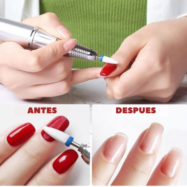 Torno de uñas y pies - Imagen 2